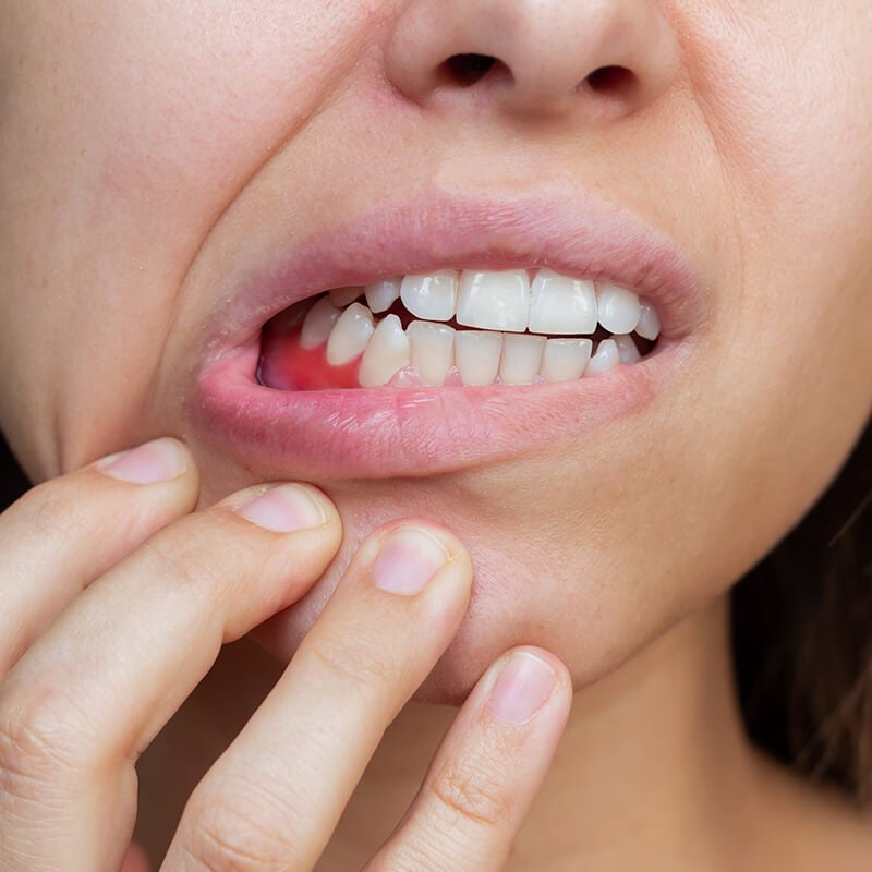 Gum infection: Symptoms, causes, treatment and prevention methods