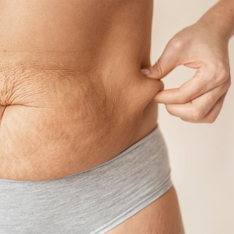 liposuction cost in Turkey