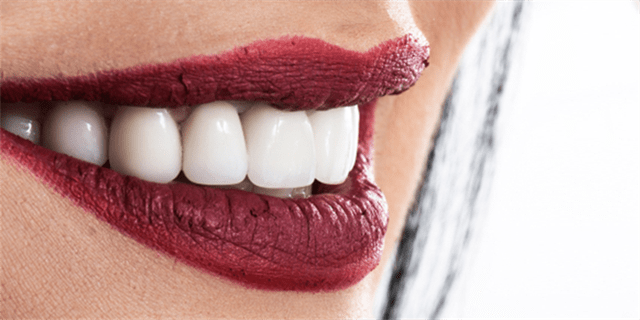 ما هي التعليمات الضرورية التي ينبغي اتباعها ما بعد إجراء ابتسامة هوليود؟