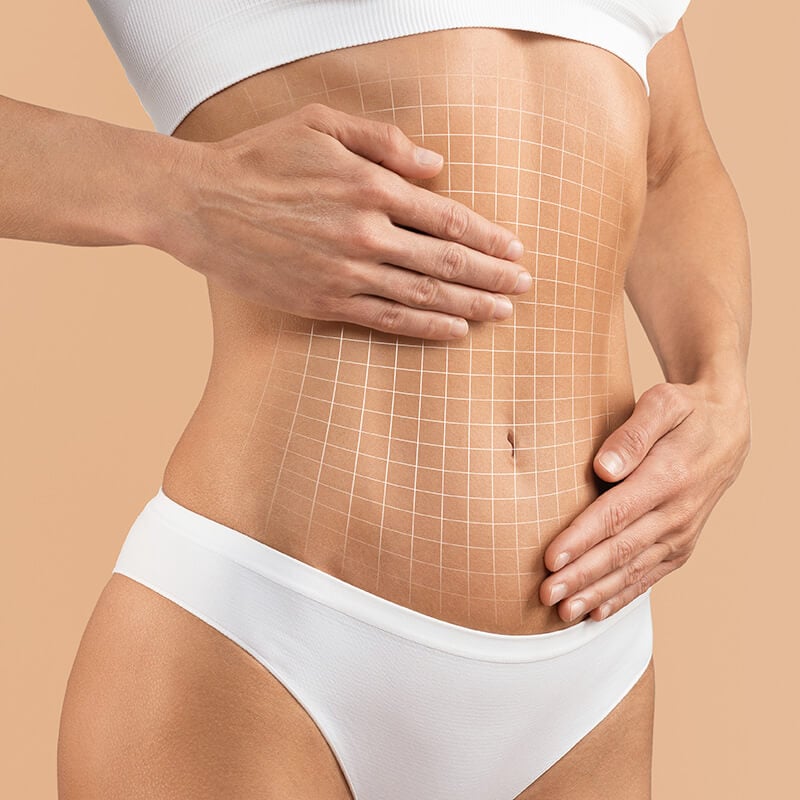  Tummy tuck cost in Turkey