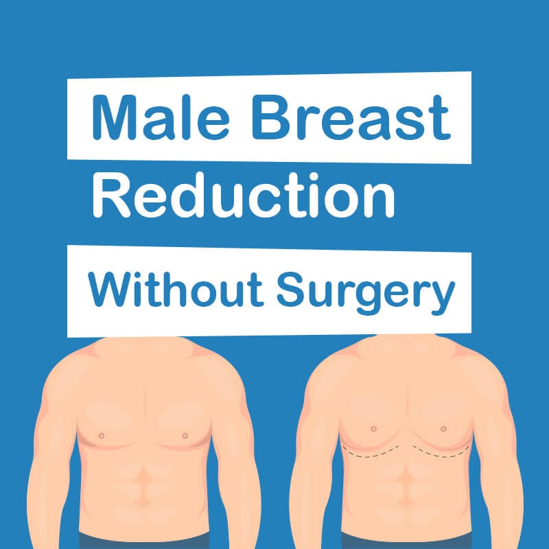 Male breast reduction without surgery