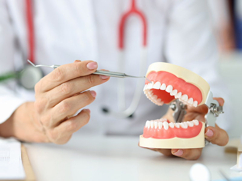 What are dental fillings? 