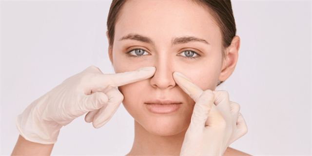 Open Rhinoplasty