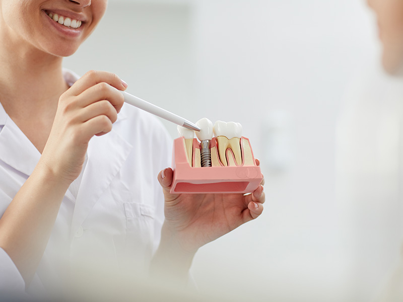 Immediate dental implant benefits 