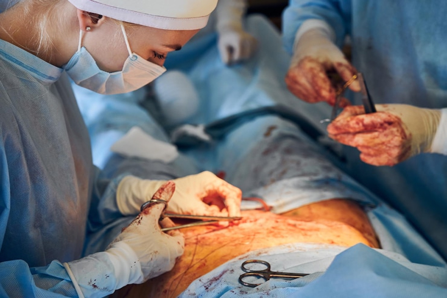 Sleeve gastrectomy vs gastric bypass