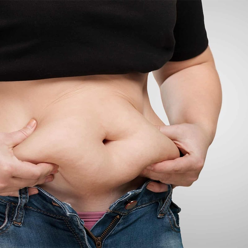 Bariatric surgery price in Turkey