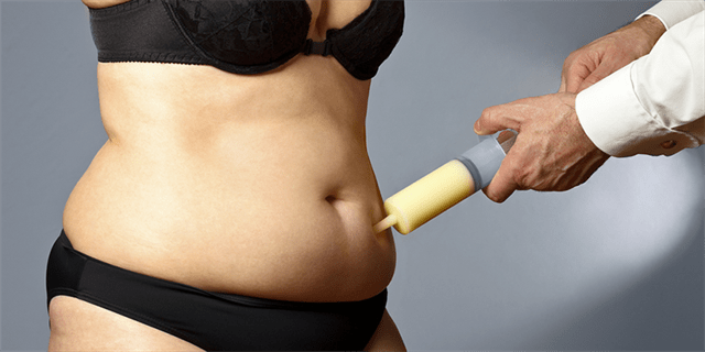 What are the post-operative instructions for liposuction?