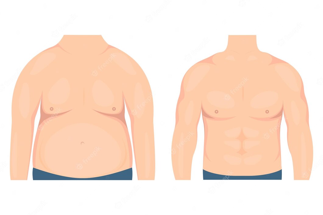 Gynecomastia Surgery Results: What to Expect