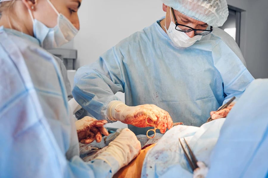 Liposuction surgery