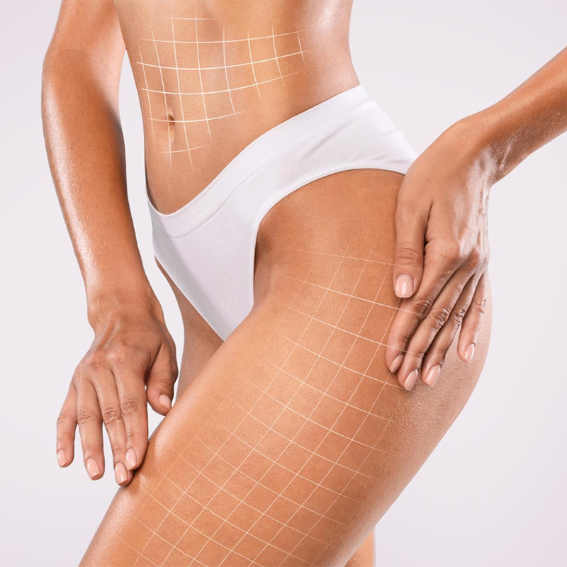 Thigh Lift Surgery in Turkey