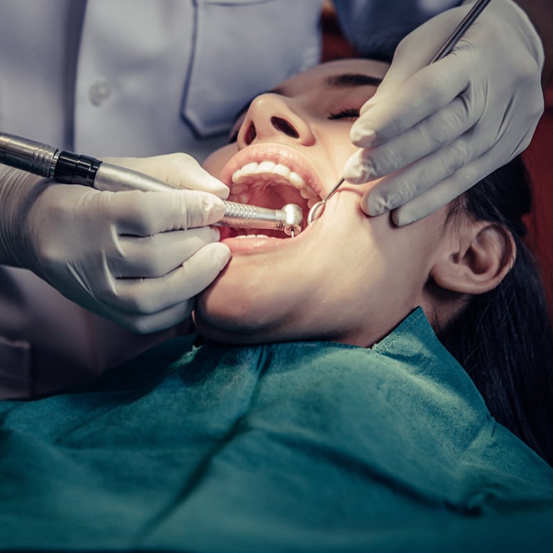 Root canal procedure: purpose, steps, recovery, and side effects