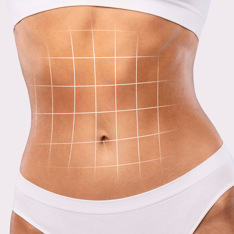 Tummy tuck recovery