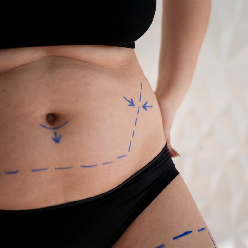 gastric sleeve surgery cost in Turkey