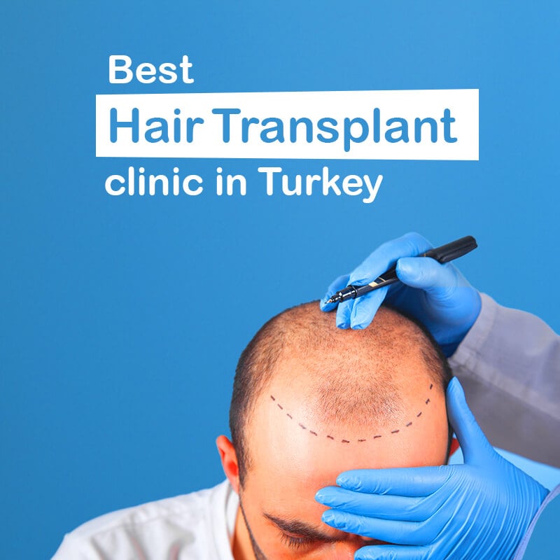 Best hair transplant clinic in Turkey