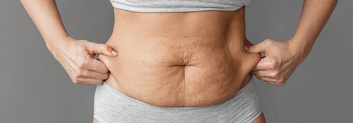 All the ways you can get rid of cellulite