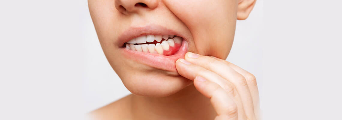 Gum infection: Symptoms, causes, treatment and prevention methods