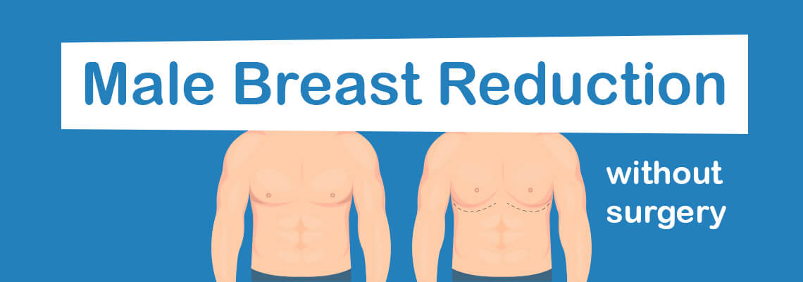 Male breast reduction without surgery