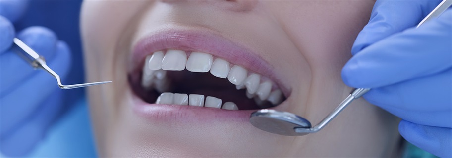 Procédure d'implantation dentaire en Turquie 2023