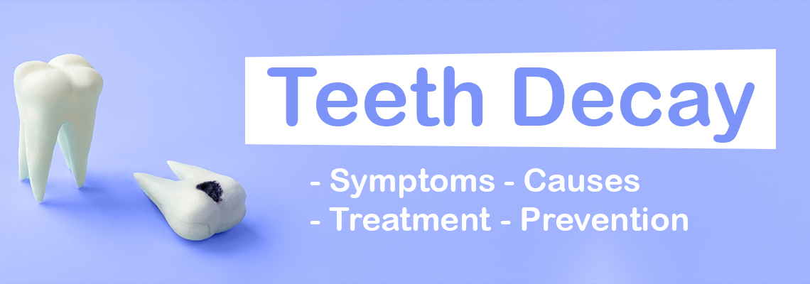 تسوس الأسنان وأعراضه وأسبابه ومراحله وعلاجه والوقاية منه 
