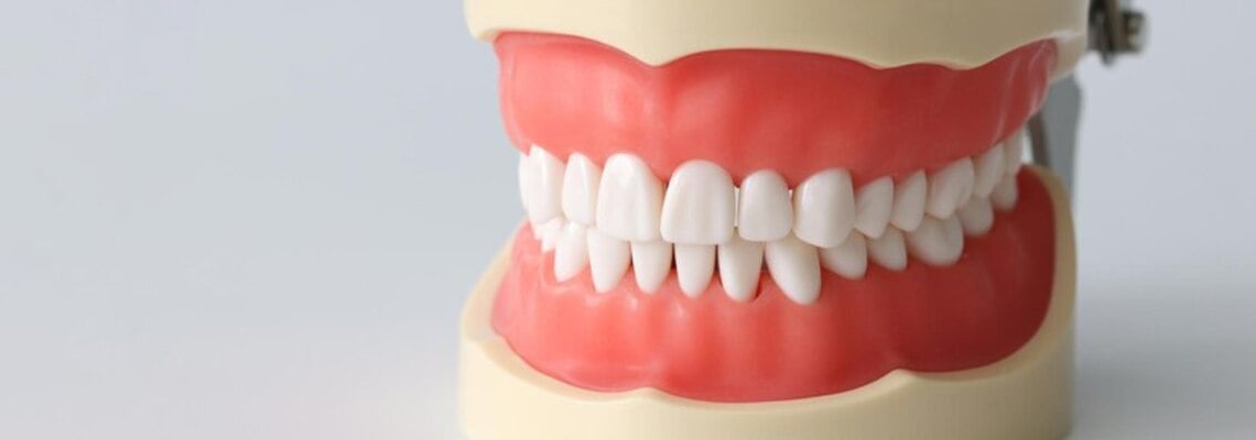 Dental-crowns-in-Turkey