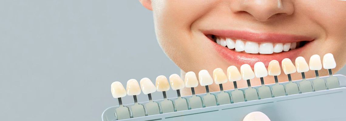 Emax veneers in Turkey: pros and cons, durability, appearance and cost 