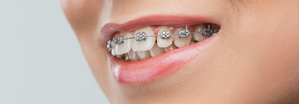 Orthodontics