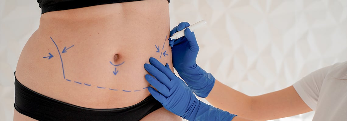 How do tummy tuck and lipo done together?
